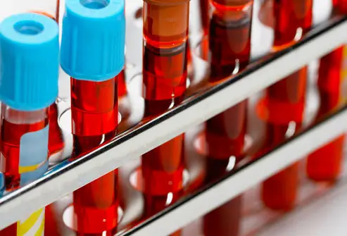 Blood labs