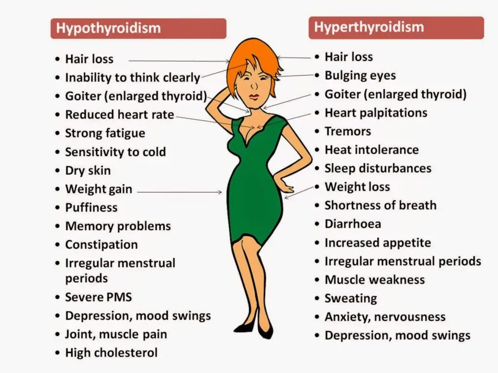 Thyroid dysfunctions symptoms